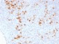 Anti-Kappa Light Chain (B-Cell Marker) Antibody