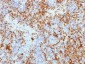 Anti-CD61 / Integrin beta-3 / Platelet Glycoprotein IIIa Antibody