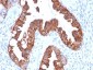 Anti-Cytokeratin 7 Antibody