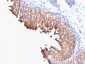 Anti-Cytokeratin 10 Antibody