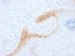 Anti-Cytokeratin 15 (KRT15) (Basal Cell Marker) Antibody