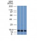 Anti-Galectin-1 / Human Placental Lactogen (hPL) Antibody