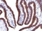 Anti-Ep-CAM / CD326 (Extracellular Domain) Antibody