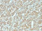 Anti-Ep-CAM / CD326 Antibody