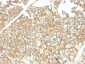 Anti-Ep-CAM / CD326 Antibody