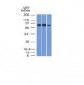 Anti-MCM7 Antibody