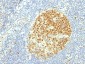 Anti-MCM7 Antibody