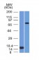 Anti-MMP2 / Collagenase Type IV A Antibody