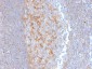 Anti-MRP1 / ABCC1 Antibody