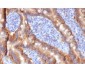 Anti-MRP1 / ABCC1 Antibody