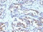 Anti-MRP1 / ABCC1 Antibody