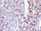 Anti-Moesin Antibody