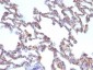 Anti-Moesin Antibody