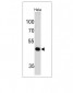 Anti-PAX7 (Rhabdomyosarcoma Marker) Antibody