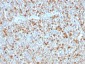 Anti-Alpha-1-Antitrypsin (SERPINA1) Antibody