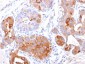 Anti-GCDFP-15 Antibody