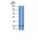 Anti-GCDFP-15 Antibody