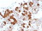 Anti-ACTH Antibody