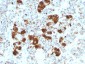 Anti-ACTH (C-Terminal) Antibody