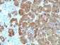 Anti-ACTH (C-Terminus) Antibody