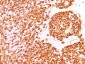Anti-CD45 / LCA (B-Cell Marker) Antibody
