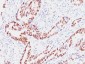 Anti-Rb1 (Tumor Suppressor Protein) Antibody