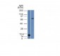 Anti-Bcl-6 Antibody