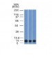 Anti-S100A4 Antibody