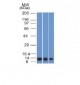 Anti-S100A4 Antibody