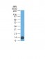 Anti-S100B Antibody