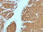 Anti-S100B Antibody