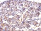 Anti-Spectrin beta III (SPTBN2) Antibody
