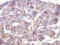 Anti-Spectrin beta III (SPTBN2) Antibody