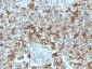 Anti-Spectrin beta III (SPTBN2) Antibody