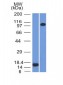 Anti-Thrombomodulin / CD141 Antibody