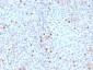 Anti-Topoisomerase II alpha Antibody