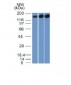 Anti-Topoisomerase II alpha Antibody