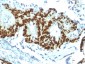 Anti-p53 Tumor Suppressor Protein Antibody