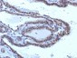 Anti-TSH-Receptor, A-Chain Antibody