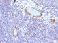 Anti-von Willebrand Factor / Factor VIII Related-Ag Antibody