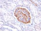 Anti-Wilm s Tumor 1 (WT1) Antibody