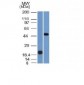 Anti-PAX8 (Renal Cell Marker) Antibody