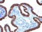 Anti-ASRGL1 (Asparaginase Like 1) Antibody