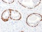 Anti-p63 Antibody