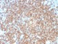 Anti-CD22 / BL-CAM Antibody
