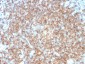 Anti-CD22 / BL-CAM Antibody