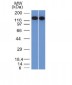 Anti-CD22 / BL-CAM Antibody