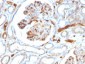 Anti-Adiponectin (Marker of Obesity) Antibody