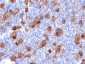 Anti-CD30 / TNFRSF8 Antibody