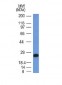 Anti-CD79a Antibody